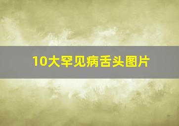 10大罕见病舌头图片