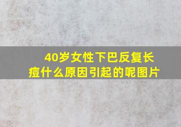 40岁女性下巴反复长痘什么原因引起的呢图片