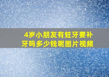 4岁小朋友有蛀牙要补牙吗多少钱呢图片视频