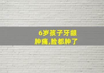 6岁孩子牙龈肿痛,脸都肿了