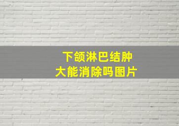 下颌淋巴结肿大能消除吗图片