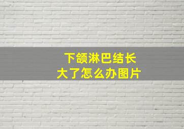 下颌淋巴结长大了怎么办图片