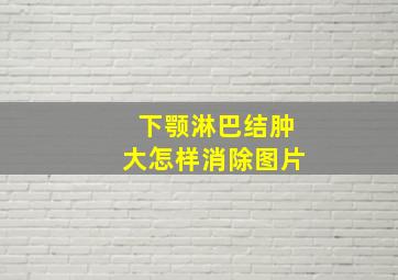 下颚淋巴结肿大怎样消除图片