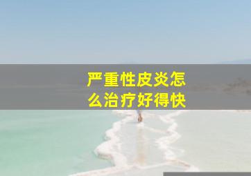 严重性皮炎怎么治疗好得快