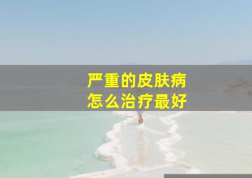 严重的皮肤病怎么治疗最好