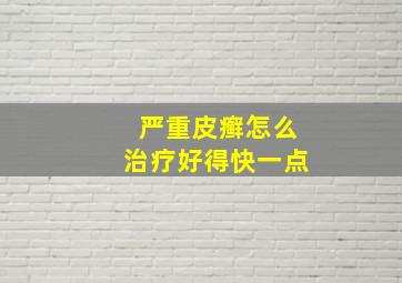 严重皮癣怎么治疗好得快一点