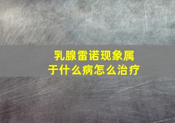 乳腺雷诺现象属于什么病怎么治疗