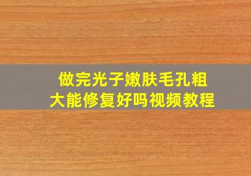 做完光子嫩肤毛孔粗大能修复好吗视频教程