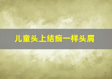 儿童头上结痂一样头屑