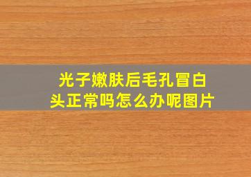 光子嫩肤后毛孔冒白头正常吗怎么办呢图片