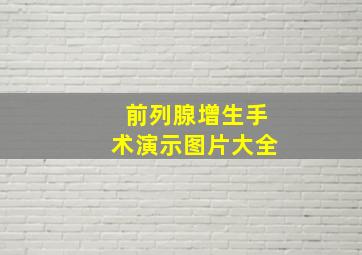 前列腺增生手术演示图片大全