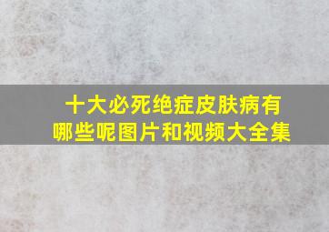 十大必死绝症皮肤病有哪些呢图片和视频大全集