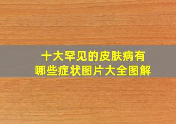 十大罕见的皮肤病有哪些症状图片大全图解