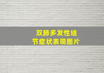 双肺多发性结节症状表现图片