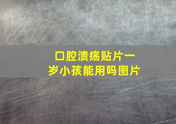 口腔溃疡贴片一岁小孩能用吗图片