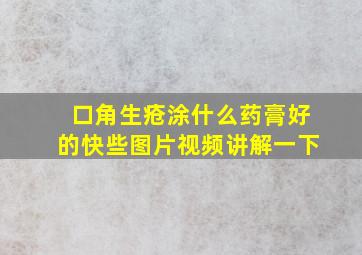 口角生疮涂什么药膏好的快些图片视频讲解一下