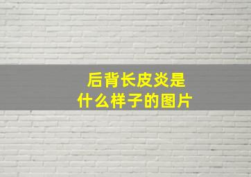 后背长皮炎是什么样子的图片