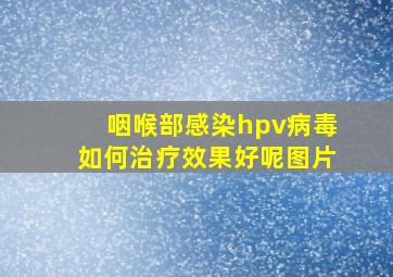 咽喉部感染hpv病毒如何治疗效果好呢图片