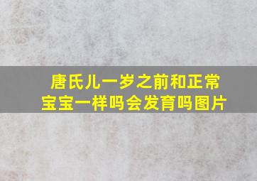 唐氏儿一岁之前和正常宝宝一样吗会发育吗图片