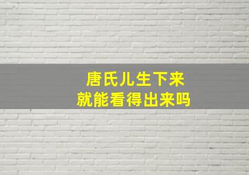 唐氏儿生下来就能看得出来吗