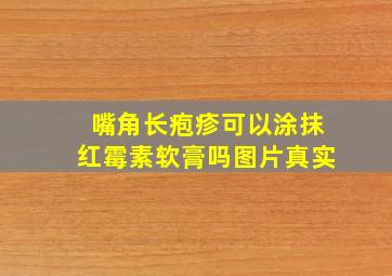 嘴角长疱疹可以涂抹红霉素软膏吗图片真实