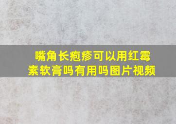 嘴角长疱疹可以用红霉素软膏吗有用吗图片视频