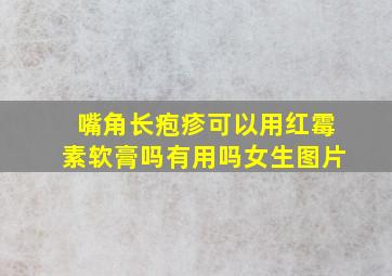 嘴角长疱疹可以用红霉素软膏吗有用吗女生图片