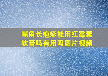 嘴角长疱疹能用红霉素软膏吗有用吗图片视频