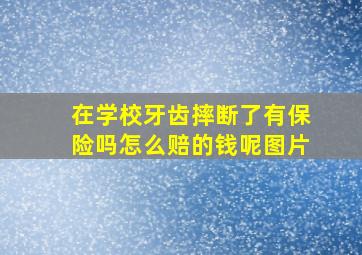 在学校牙齿摔断了有保险吗怎么赔的钱呢图片