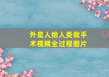 外星人给人类做手术视频全过程图片