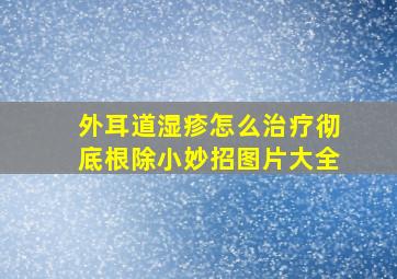 外耳道湿疹怎么治疗彻底根除小妙招图片大全