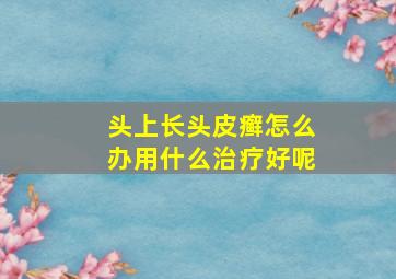 头上长头皮癣怎么办用什么治疗好呢