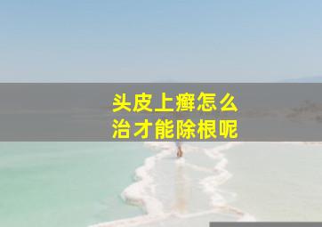 头皮上癣怎么治才能除根呢