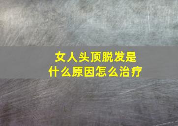 女人头顶脱发是什么原因怎么治疗