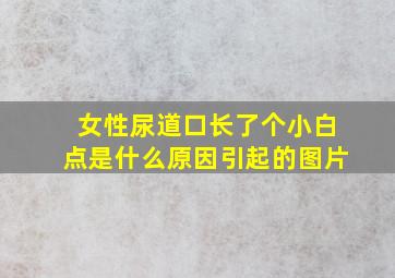 女性尿道口长了个小白点是什么原因引起的图片