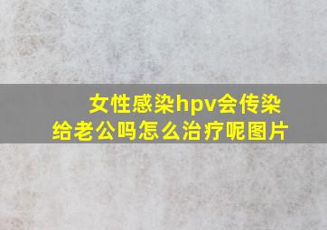 女性感染hpv会传染给老公吗怎么治疗呢图片