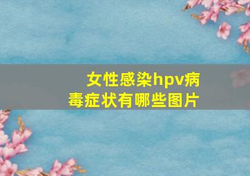 女性感染hpv病毒症状有哪些图片