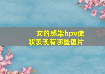 女的感染hpv症状表现有哪些图片