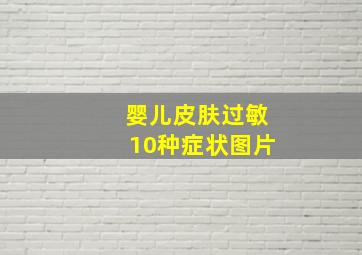 婴儿皮肤过敏10种症状图片