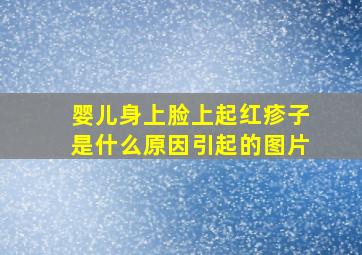 婴儿身上脸上起红疹子是什么原因引起的图片