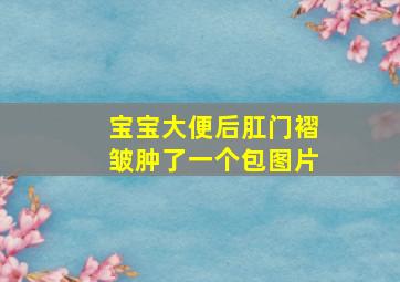 宝宝大便后肛门褶皱肿了一个包图片