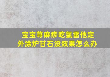 宝宝荨麻疹吃氯雷他定外涂炉甘石没效果怎么办