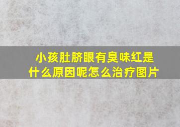 小孩肚脐眼有臭味红是什么原因呢怎么治疗图片