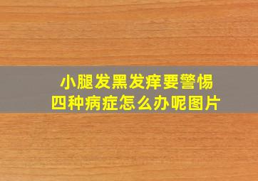 小腿发黑发痒要警惕四种病症怎么办呢图片