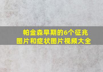 帕金森早期的6个征兆图片和症状图片视频大全