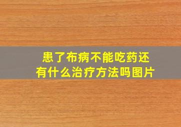 患了布病不能吃药还有什么治疗方法吗图片