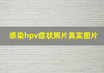 感染hpv症状照片真实图片