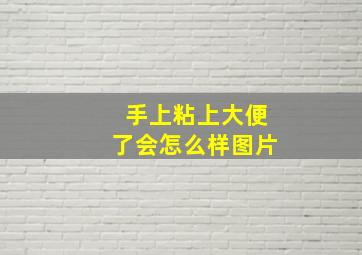 手上粘上大便了会怎么样图片