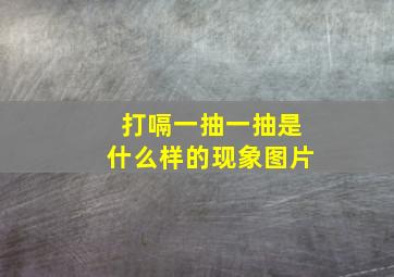 打嗝一抽一抽是什么样的现象图片