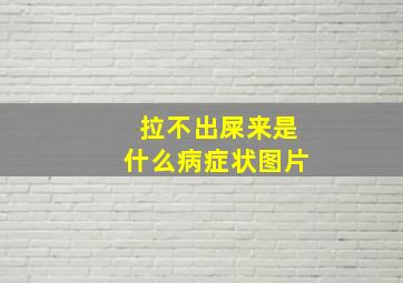 拉不出屎来是什么病症状图片